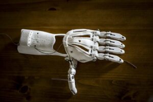  3d Printed Prosthetics